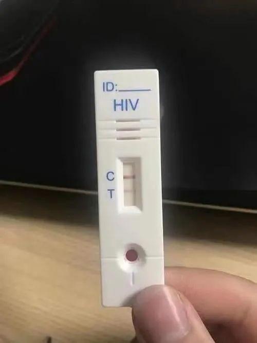 艾滋病血检测